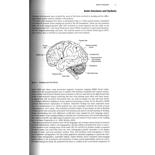 Teaching Literacy to Learners with Dyslexia (4th Edition) - Image 3